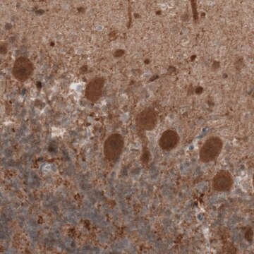 Monoclonal Anti-UCHL1 antibody produced in mouse Prestige Antibodies&#174; Powered by Atlas Antibodies, clone CL3210, purified immunoglobulin, buffered aqueous glycerol solution