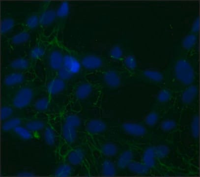 Monoclonal Anti-Fibronectin, Cellular antibody produced in mouse clone FN-3E2, ascites fluid