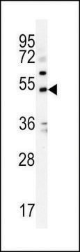 ANTI-KCNJ6 (CENTER) antibody produced in rabbit affinity isolated antibody, buffered aqueous solution