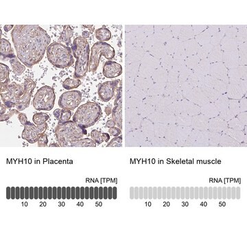 Anti-MYH10 antibody produced in rabbit Prestige Antibodies&#174; Powered by Atlas Antibodies, affinity isolated antibody, buffered aqueous glycerol solution