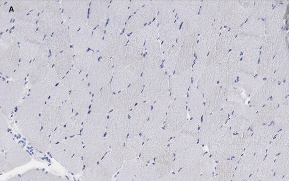 Anti-alpha Actinin 2 Antibody, clone 1E11, ZooMAb&#174; Rabbit Monoclonal recombinant, expressed in HEK 293 cells