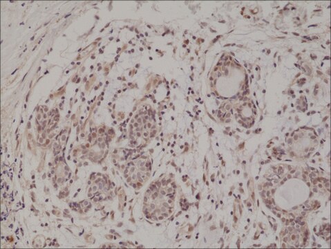 Anti-AKT (PH domain) antibody, Rabbit monoclonal recombinant, expressed in HEK 293 cells, clone RM316, purified immunoglobulin