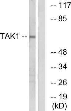 Anti-TAK1 antibody produced in rabbit affinity isolated antibody