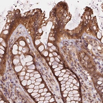 Anti-MEX3D antibody produced in rabbit Prestige Antibodies&#174; Powered by Atlas Antibodies, affinity isolated antibody, buffered aqueous glycerol solution