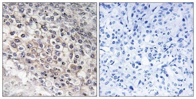 Anti-Cytochrome P450 2W1 antibody produced in rabbit affinity isolated antibody