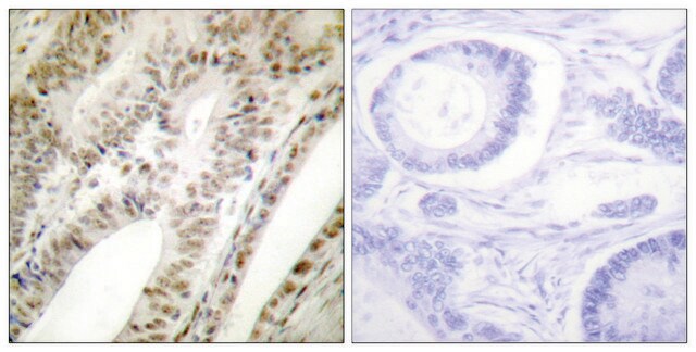 Anti-PML antibody produced in rabbit affinity isolated antibody