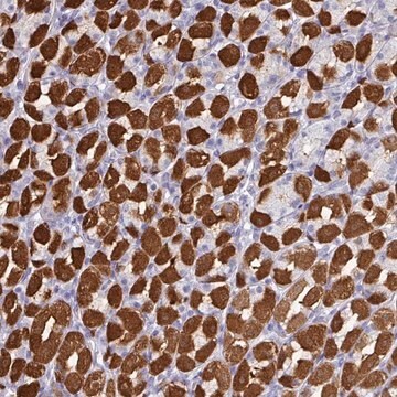 Anti-PEX10 antibody produced in rabbit Prestige Antibodies&#174; Powered by Atlas Antibodies, affinity isolated antibody, buffered aqueous glycerol solution