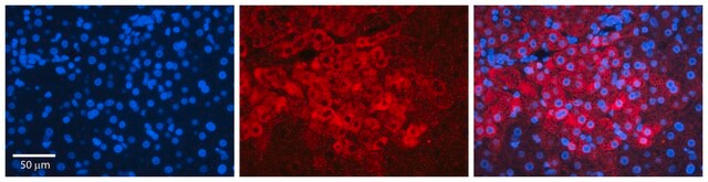 Anti-IRF1 (AB2) antibody produced in rabbit affinity isolated antibody