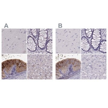 Anti-WFDC8 Prestige Antibodies&#174; Powered by Atlas Antibodies, affinity isolated antibody