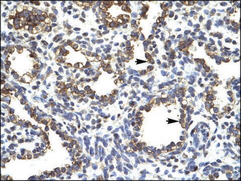 Anti-SOX5 affinity isolated antibody