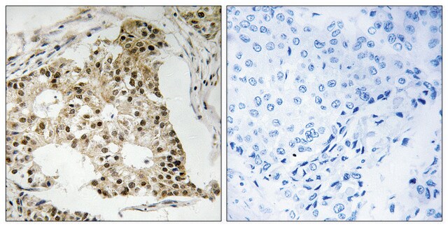 Anti-Retinoic Acid Receptor A (Phospho-SER77) affinity isolated antibody