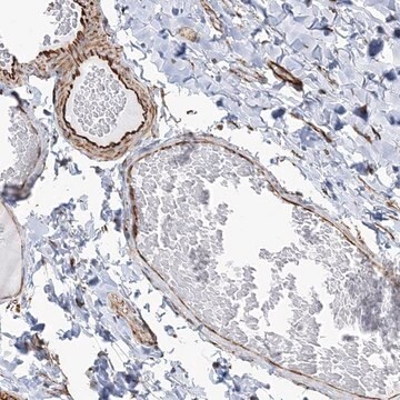 Anti-SCLT1 antibody produced in rabbit Prestige Antibodies&#174; Powered by Atlas Antibodies, affinity isolated antibody, buffered aqueous glycerol solution