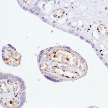 Anti-Haemoglobin Alpha Chain antibody, Rabbit monoclonal clone SP212, recombinant, expressed in proprietary host, affinity isolated antibody