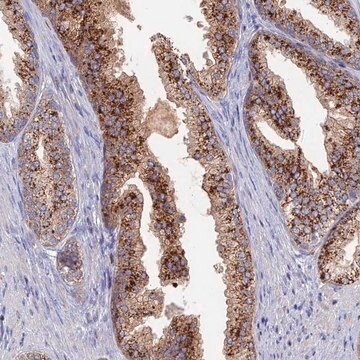 Anti-ARL16 antibody produced in rabbit Prestige Antibodies&#174; Powered by Atlas Antibodies, affinity isolated antibody, buffered aqueous glycerol solution