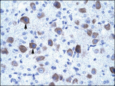 Anti-KCNIP4 antibody produced in rabbit affinity isolated antibody