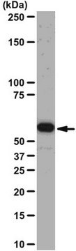 Anti-Akt1/PKB&#945; Antibody, clone AW24 | 04-796 clone AW24, from rabbit