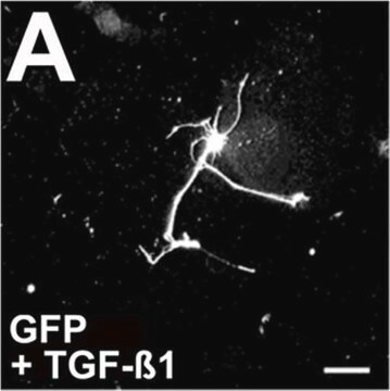 Anti-Neurofilament 200 kDa Antibody, clone RT97 clone RT97, Chemicon&#174;, from mouse