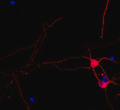 Anti-Beta III Tubulin, Cy3 Conjugate Antibody from rabbit, CY3 conjugate