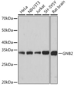 Anti-GNB2 Antibody, clone 6U9B3, Rabbit Monoclonal