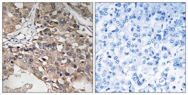 Anti-MAP3K7 antibody produced in rabbit affinity isolated antibody