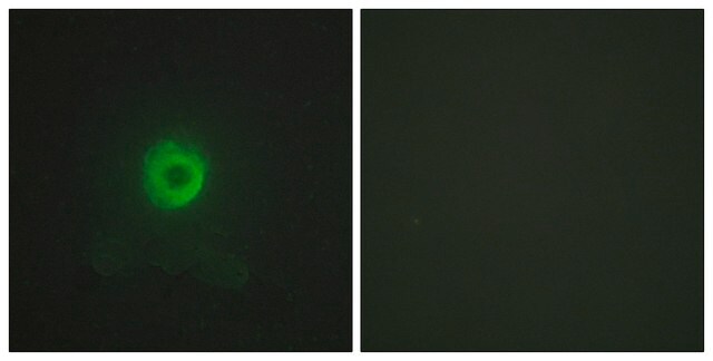 Anti-TNF Receptor II, antibody produced in rabbit affinity isolated antibody