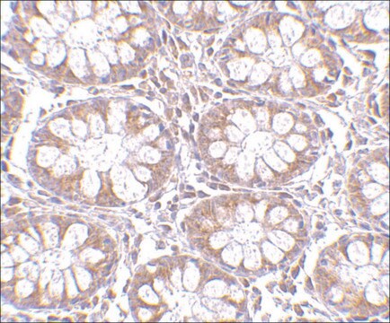 Anti-TEM1 (ab1) antibody produced in rabbit affinity isolated antibody, buffered aqueous solution