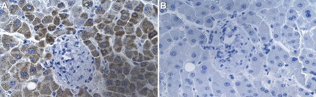 Anti-CCL20/MIP-3&#945; Antibody, clone 1F5-H1 ZooMAb&#174; Rabbit Monoclonal recombinant, expressed in HEK 293 cells