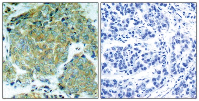 Anti-phospho-EIF2S1 (pSer51) antibody produced in rabbit affinity isolated antibody