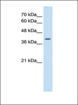 Anti-WNT2B antibody produced in rabbit affinity isolated antibody