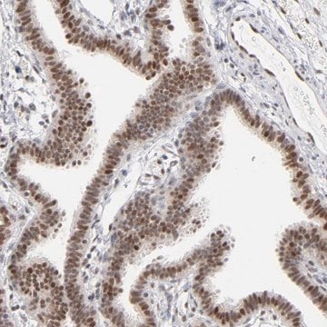 ANTI-IRF9 antibody produced in rabbit Ab2, Prestige Antibodies&#174; Powered by Atlas Antibodies, affinity isolated antibody, buffered aqueous glycerol solution