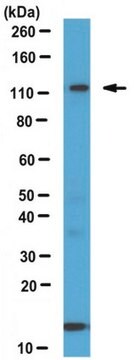 Anti-GPR56, C-terminal Antibody from rabbit, purified by affinity chromatography