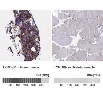 Anti-TYROBP antibody produced in rabbit Prestige Antibodies&#174; Powered by Atlas Antibodies, affinity isolated antibody, buffered aqueous glycerol solution