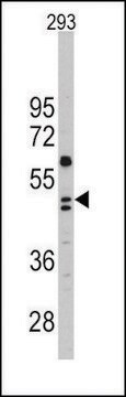 Anti-CHRD (C-term) antibody produced in rabbit affinity isolated antibody, buffered aqueous solution