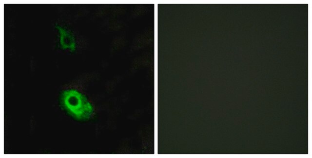 Anti-EDG3 antibody produced in rabbit affinity isolated antibody