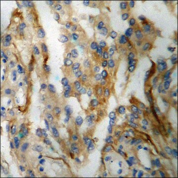 Anti-phospho-Aquaporin 2 (pSer256) antibody produced in rabbit affinity isolated antibody