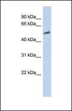 Anti-IKZF2 antibody produced in rabbit affinity isolated antibody