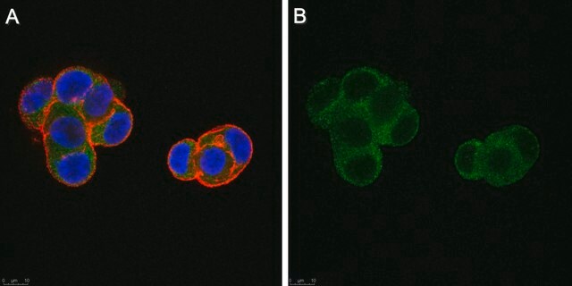 Anti-Estradiol (6-BSA) Antibody purified antibody, clone 6E1, from mouse