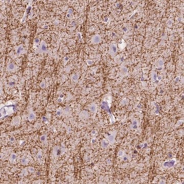 Anti-SIRT2 antibody produced in rabbit Prestige Antibodies&#174; Powered by Atlas Antibodies, affinity isolated antibody, buffered aqueous glycerol solution