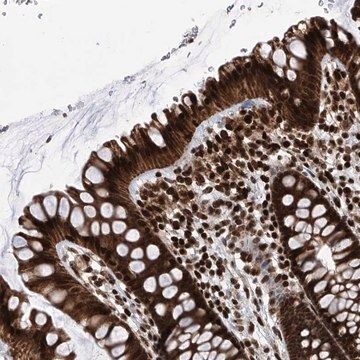 Anti-PAK1IP1 antibody produced in rabbit Prestige Antibodies&#174; Powered by Atlas Antibodies, affinity isolated antibody, buffered aqueous glycerol solution