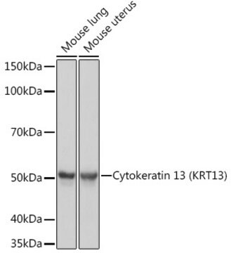 Anti-Cytokeratin 13 (KRT13) Antibody, clone 5M6B10, Rabbit Monoclonal