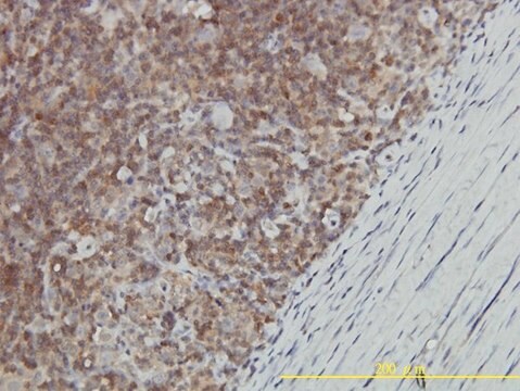 Monoclonal Anti-GALT antibody produced in mouse clone 4C11, purified immunoglobulin, buffered aqueous solution