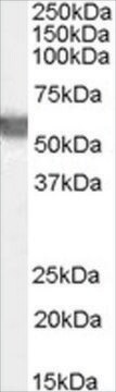 Anti-G6PD (AA 308-320) antibody produced in goat affinity isolated antibody, buffered aqueous solution