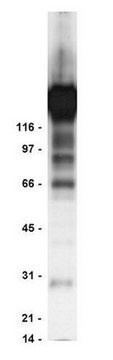 Anti-Phosphotyrosine Antibody, clone 4G10&#174;, agarose conjugate clone 4G10®, Upstate&#174;, from mouse