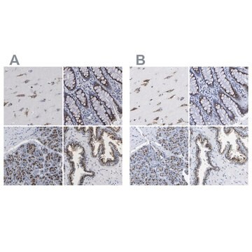 Anti-TMEM87A antibody produced in rabbit Prestige Antibodies&#174; Powered by Atlas Antibodies, affinity isolated antibody, buffered aqueous glycerol solution