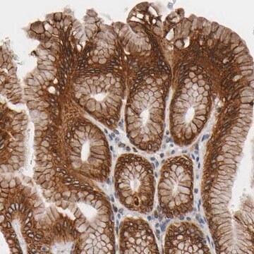 Anti-ASB6 antibody produced in rabbit Prestige Antibodies&#174; Powered by Atlas Antibodies, affinity isolated antibody, buffered aqueous glycerol solution