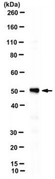 Anti-&#946;-Tubulin Antibody, clone AA2