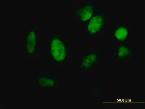 抗ID1抗体 マウス宿主抗体 purified immunoglobulin, buffered aqueous solution