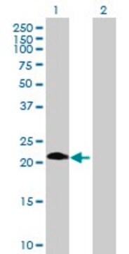 Anti-ASB6 antibody produced in mouse purified immunoglobulin, buffered aqueous solution