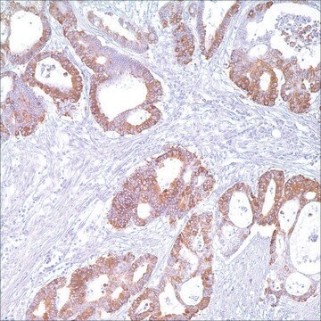 COX-2 (SP21) Rabbit Monoclonal Antibody