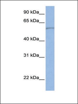 Anti-SLC22A11 (AB1) antibody produced in rabbit affinity isolated antibody